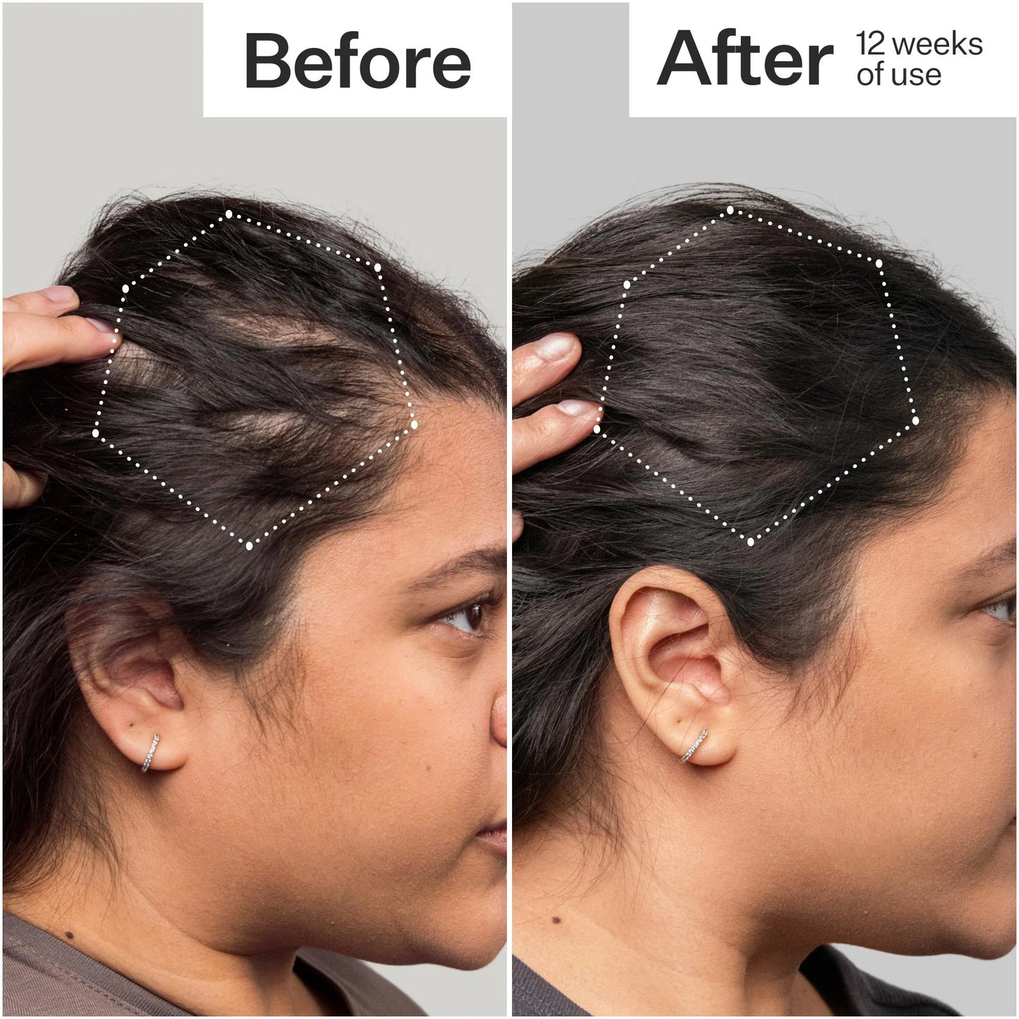 3% Stem Cell Peptide Treatment