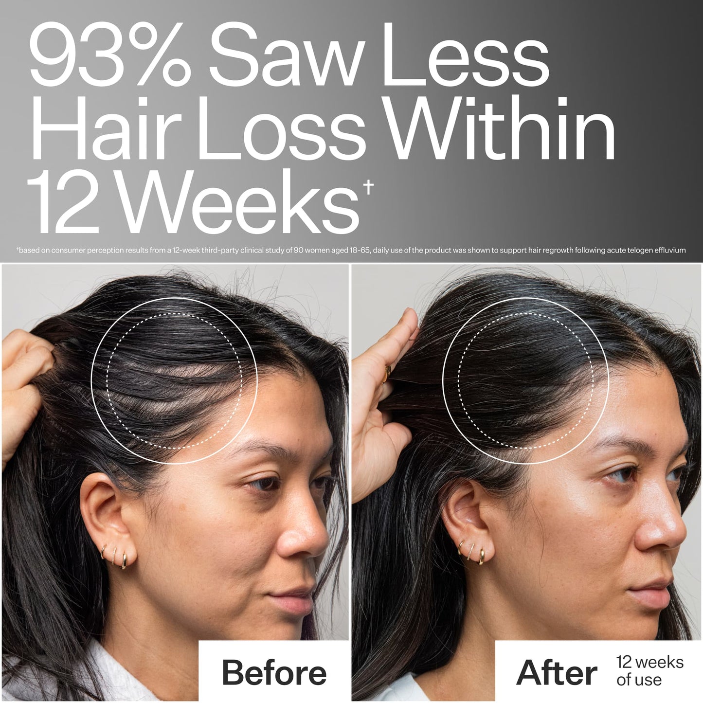 3% Stem Cell Peptide Treatment