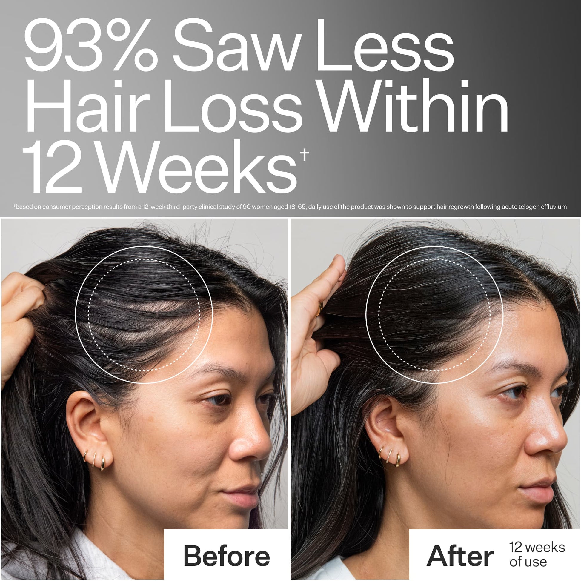 3% Stem Cell Peptide Treatment